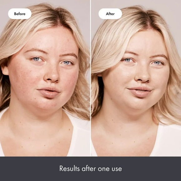 Hero redness-correcting Rescue Balm acne moisturizer spot treatment - Picture 2 of 6